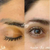 خدمات حرفه ای پاکسازی ریموو تتو و فیشال و جوانسازی|خدمات آرایشگری و زیبایی|هشتگرد, فاز ۱ مهستان|دیوار