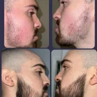 تا کی میخوایی کوسه بمونی