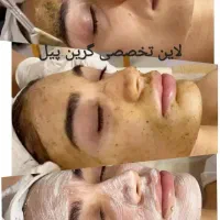 خدمات فیشیال حرفه ای و تراپی های تخصصی پوست|خدمات آرایشگری و زیبایی|تهران, تهرانسر شمالی|دیوار