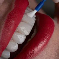 کلیه خدمات دهان دندان ایمپلنت کامپوزیت|خدمات آرایشگری و زیبایی|رشت, گلسار|دیوار