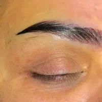 کاشت ابرو توسط تیم V.I.P تحت نظر پزشک متخصص کلینیک
