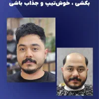 جایگزین مناسب کاشت مو (ترمیم مو)|آرایشی، بهداشتی، درمانی|اصفهان, دستگرده|دیوار