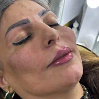 ژل و بوتاکس فرنیا بیوتی|خدمات آرایشگری و زیبایی|شهریار, شهرک وائین|دیوار