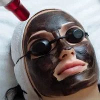 کربن‌تراپی‌ودرمان‌ترک‌های‌پوستی(استرچ‌مارک)