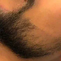 کاشت ممنوع