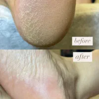 خدمات ویژه پدیکور و اسپا|خدمات آرایشگری و زیبایی|شیراز, شهرک والفجر|دیوار