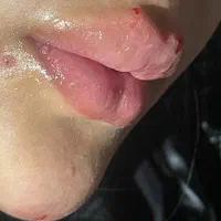 ژل و بوتاکس ‌‌پاکسازی|خدمات آرایشگری و زیبایی|مشهد, شهید معقول|دیوار