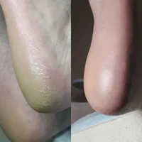 پدیکور (محدوده سپیدار)|خدمات آرایشگری و زیبایی|اهواز, سپیدار|دیوار