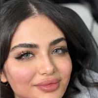 اف یلدایی ژل و بوتاکس|خدمات آرایشگری و زیبایی|اهواز, کوی ملی راه|دیوار