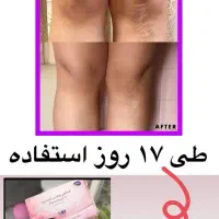 پک روشنایی ورفع تیرگی صورت وبدن|حراج|زرند, |دیوار