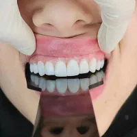 دندانپزشکی|خدمات آرایشگری و زیبایی|ارومیه, |دیوار