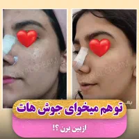 اگه دنبال پوست خوبی پیام بده|آرایشی، بهداشتی، درمانی|خلخال, |دیوار