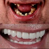 کلیه خدمات دندانپزشکی . زیبایی|خدمات آرایشگری و زیبایی|رشت, گلسار|دیوار