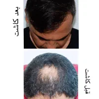 انفجار زیبایی فقط با ۹ میلیون تومان|خدمات آرایشگری و زیبایی|تهران, زعفرانیه|دیوار