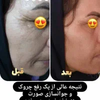 لاغری واصلاح مزاج بصورت ۱۰۰درصدتضمینی|آرایشی، بهداشتی، درمانی|اهواز, بهارستان|دیوار
