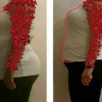 لاغری به آسانی بدون ورزش و رژیم|آرایشی، بهداشتی، درمانی|نیشابور, شهرک اندیشه|دیوار