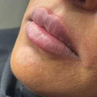 تخفیف جشنواره فیلر لب، زیرچشم ، صورت ، دست و بدن|خدمات آرایشگری و زیبایی|شیراز, قصرالدشت|دیوار