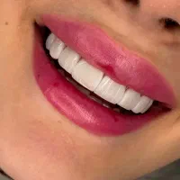 ۵۰ درصد تخفیف خدمات زیبایی و درمانی