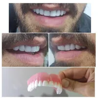 دسته کامل اورجینال
