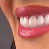 دندانپزشکی و ایمپلنت و کامپوزیت و ارتودنسی|خدمات آرایشگری و زیبایی|سرپل ذهاب, |دیوار