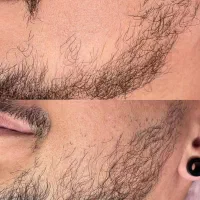 بازی بازی ریشات بلند میشه