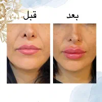 مدل رایگان لاغری، پوست و زیبایی (مدت محدود)