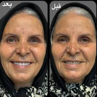 مرکز ساخت تخصصی دندان مصنوعی،دندانسازی باضمانت
