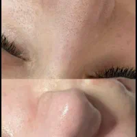 فیشیال|خدمات آرایشگری و زیبایی|دهدشت, |دیوار