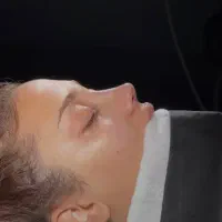 جراحی بینی عمل بینی بلفارو ساکشن غبغب لیفت صورت|خدمات آرایشگری و زیبایی|مشهد, احمدآباد|دیوار