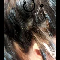 رفع شپش و رشک تضمینی زیر نظر بهداشت بامحلول گیاهی|خدمات آرایشگری و زیبایی|قم, نیروگاه|دیوار