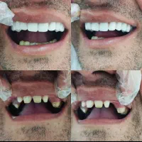 دندانپزشکی با پرداخت یک سوم هزینه|خدمات آرایشگری و زیبایی|سقز, |دیوار