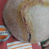پزشک متخصص تزریقات سرم خدمات پرستاری درمنزل کل شهر|خدمات آرایشگری و زیبایی|مشهد, سجاد شهر|دیوار