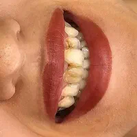 خدمات دندان پزشکی با تخفیف ویژه پاییز ( 50٪ )سنندج|خدمات آرایشگری و زیبایی|مریوان, |دیوار