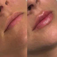 آف ویژه خدمات ژل