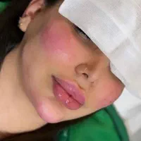 مرکز تخصصی ژل بوتاکس /کاشت امبدینگ لاغری در مطب|خدمات آرایشگری و زیبایی|کرمانشاه, |دیوار