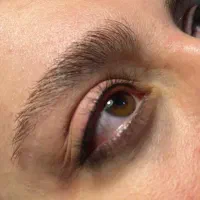 تخفیف ویژه بن مژه خط چشم‌شیدینگ‌لب