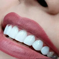 کامپوزیت ونیر فقط 3/750 تا پایان هفته|خدمات آرایشگری و زیبایی|تهران, سلسبیل جنوبی|دیوار