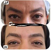 مرکزخدمات زیبایی درمانی دکتر سیدعلی پورحسینیGP|خدمات آرایشگری و زیبایی|رفسنجان, |دیوار