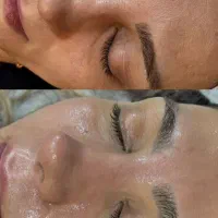 پاکسازی وفیشال های تخصصی و درمانی،احیاوکراتین مو