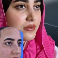 جشنواره ویژه عمل زیبایی بینی توسط متخصص|خدمات آرایشگری و زیبایی|اهواز, کیانپارس |دیوار