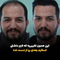 بلفارو / کاشت مو / کاشت ابرو/ رفع غبغب