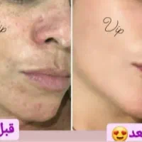 کرم شب