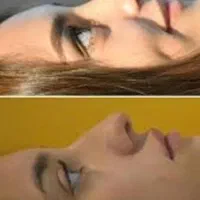 جشنواره تخفیفات ویژه عملهای زیبایی پلک و بینی و ..|خدمات آرایشگری و زیبایی|شیراز, زرگری|دیوار