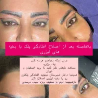 مطب زیبایی لیزر بوتاکس ژل مزو نخ لک جوش|خدمات آرایشگری و زیبایی|لردگان, |دیوار