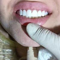 جشنواره 40% تخفیف کامپوزیت به مدت محدود