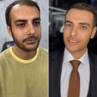 گریم تخصصی داماد  تعرفه ویژه نمونه‌کار