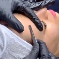 اصلاح صورت + فیشال