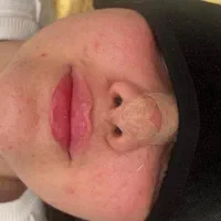تزریق ژل وبوتاکس آموزش ژل وبوتاکس آنزیم فیلربادی|خدمات آرایشگری و زیبایی|کرمانشاه, |دیوار