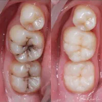 خدمات دندانپزشکی درمانی و زیبایی با وام و اقساط|خدمات زیبایی و سلامت|مشهد, زیبا شهر|دیوار