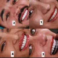 دندانپزشکی نگارام|خدمات آرایشگری و زیبایی|قم, بکایی|دیوار